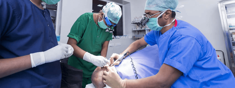 know-the-hair-transplant-surgery-clear-your-doubts