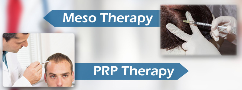 Can Mesotherapy and PRP Stimulate Hair Growth?
