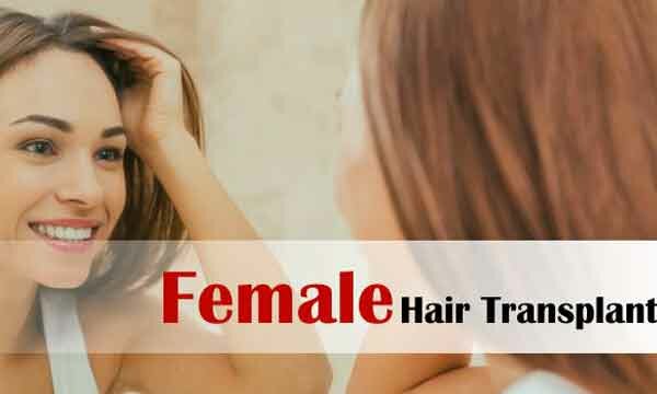 Female Hair Transplant in Delhi